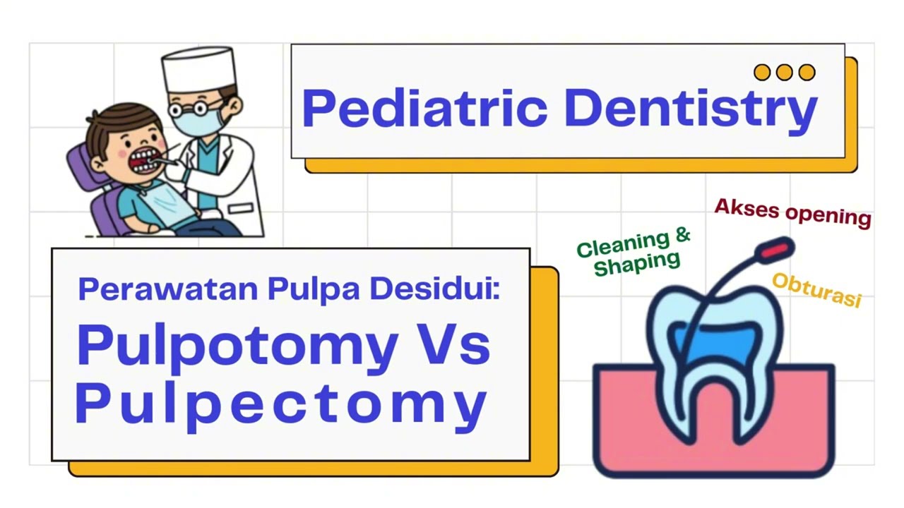 Pulpotomi Vs Pulpektomi: 2 Kunci Keberhasilan Perawatan Pulpa Gigi Desidui | Pedodonsia 101
