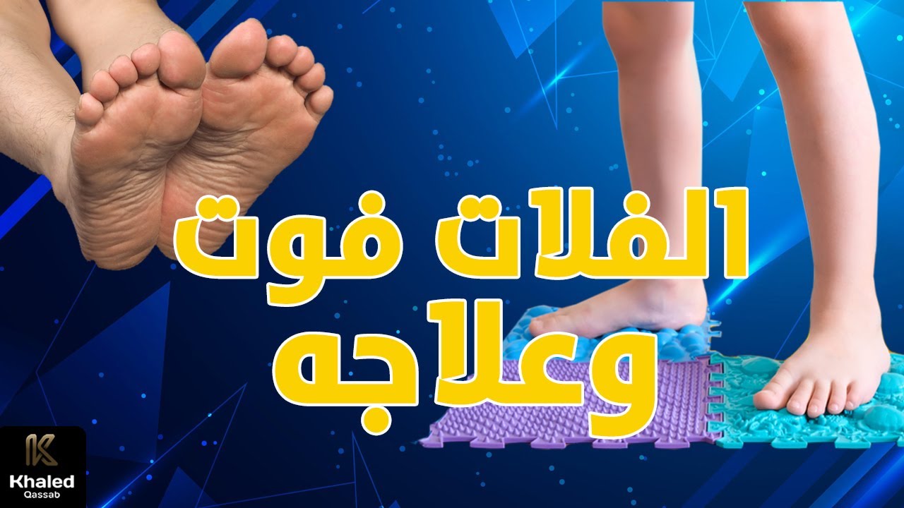 كل ما يجب أن تعرفه عن الفلات فوت وكيف تتعامل معه؟ - #الجزء_الأول
