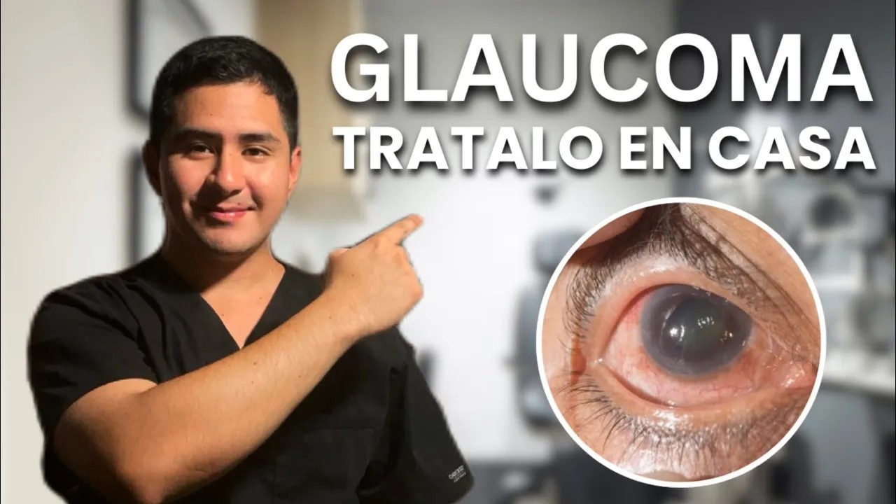 MAYORES +60: 7 MEJORES FORMAS para PREVENIR el GLAUCOMA y CATARATAS (Caseras)