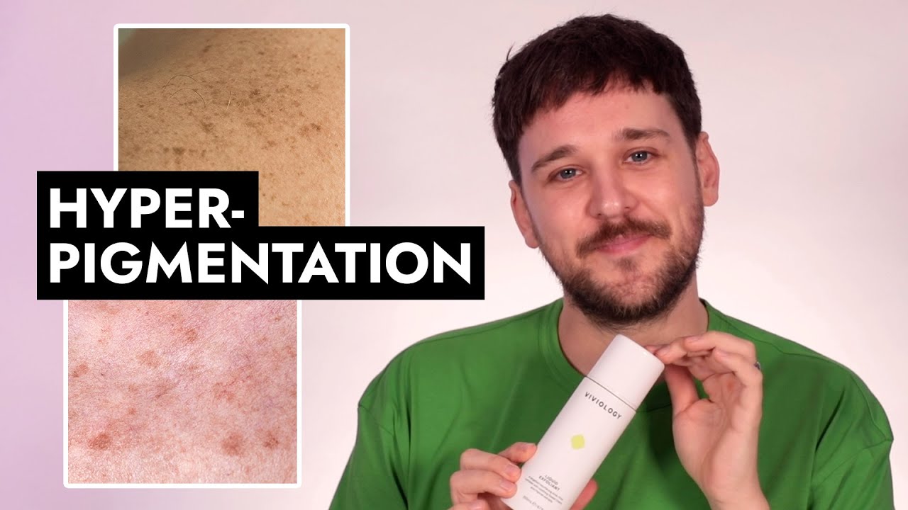Top 6 best products for hyperpigmentation | Dermal therapist favourites