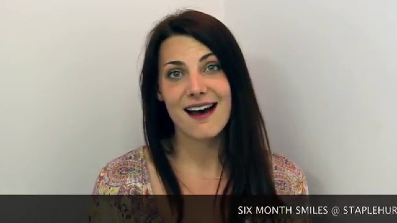Teeth Straightening with Six Month Smiles Clear Braces