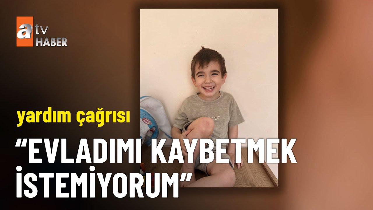 4 yaşındaki Kuzey Tanrıöver DMD ile savaşıyor - atv Haber 25 Ağustos 2025