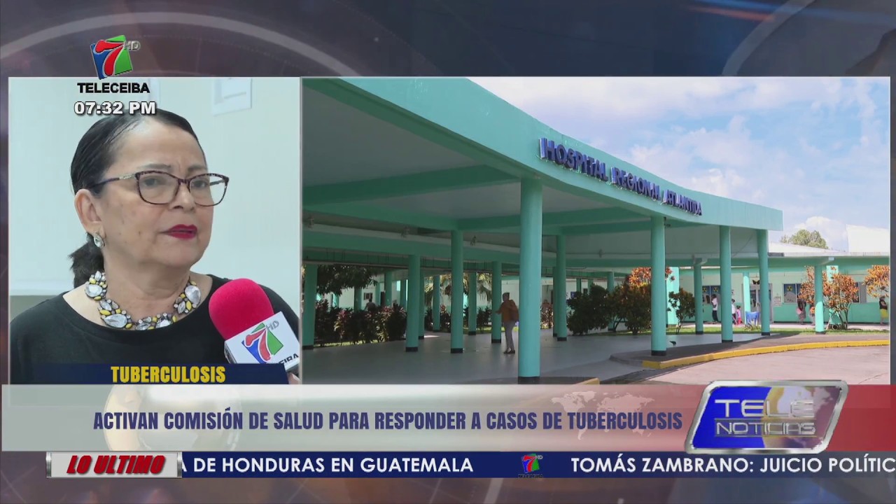 Activan comisión de salud para responder a casos de tuberculosis en el HGA