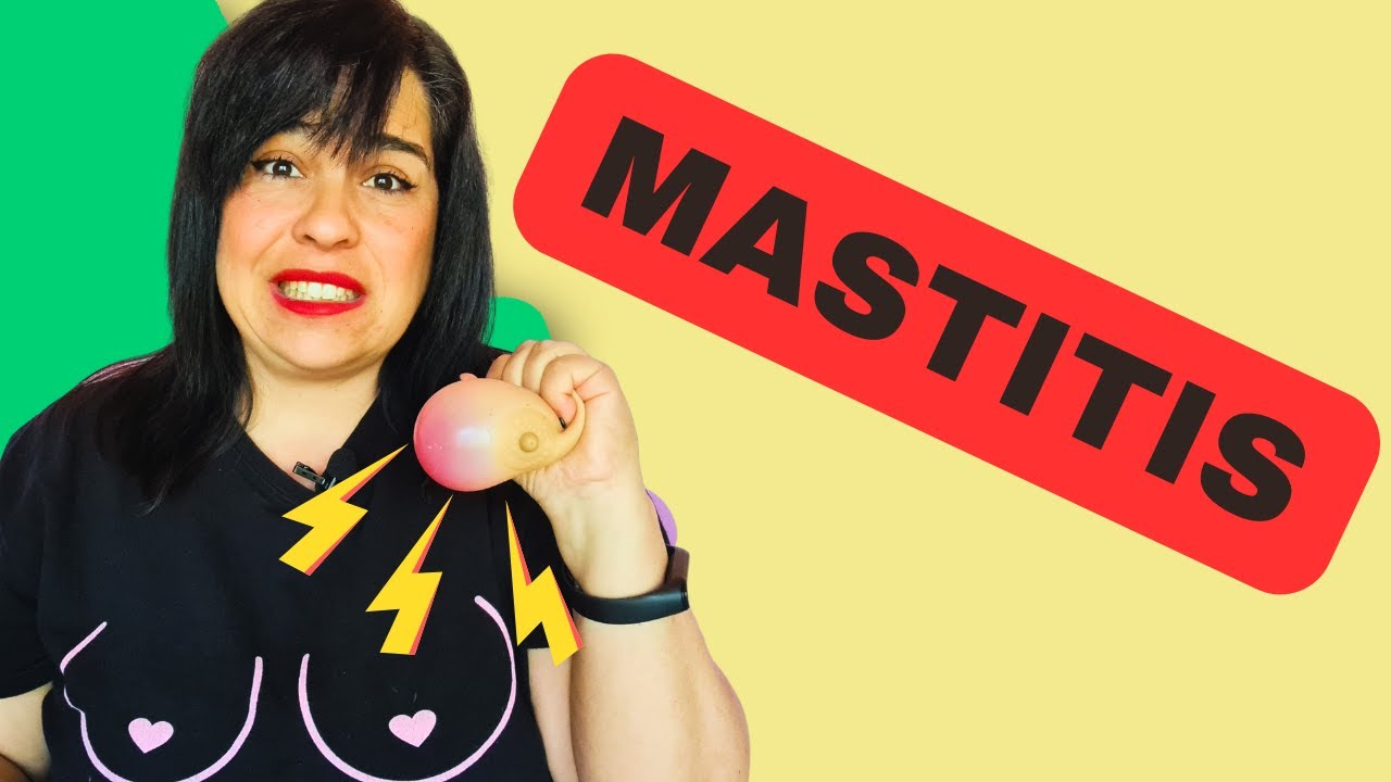 🤱🏻🔥MASTITIS en la lactancia | Causas · Clasificación · Tratamiento · Consejos para curarla