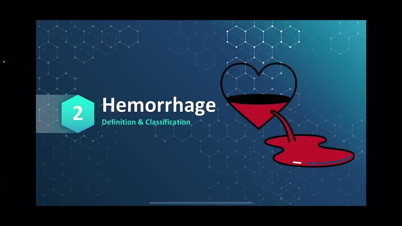 Lecture 3 Hemorrhage + blood transfusion