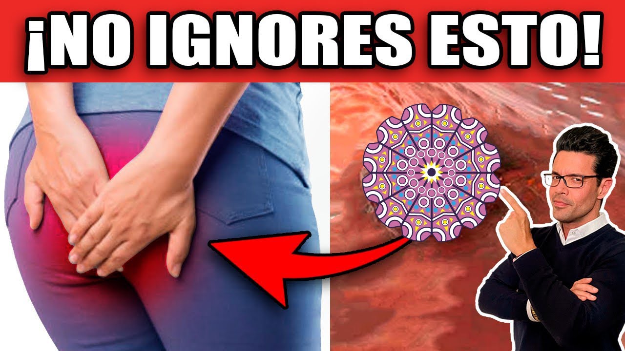 ¡CÁNCER de COLON! SÍGNOS y SÍNTOMAS de ALERTA que NUNCA DEBES IGNORAR!