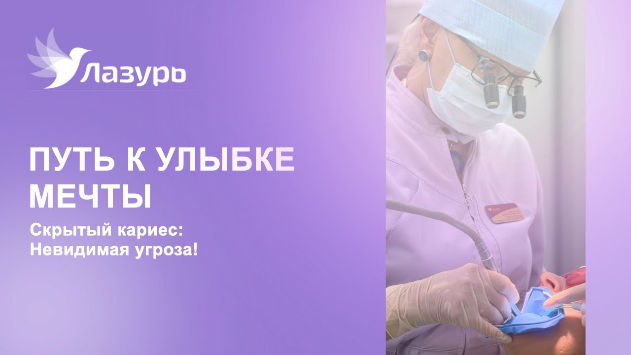 Скрытый кариес: Невидимая угроза!