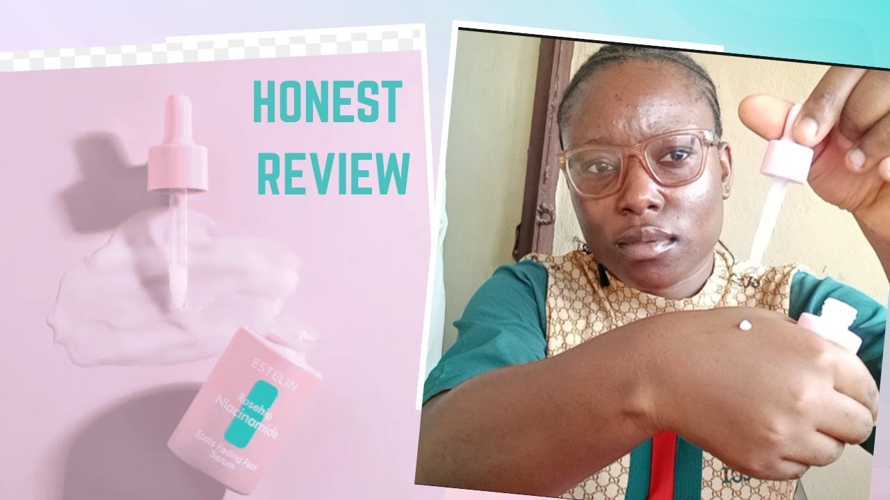 Estelin Niacinamide Serum For Acne & Dark Spots? Affordable & Effective #review