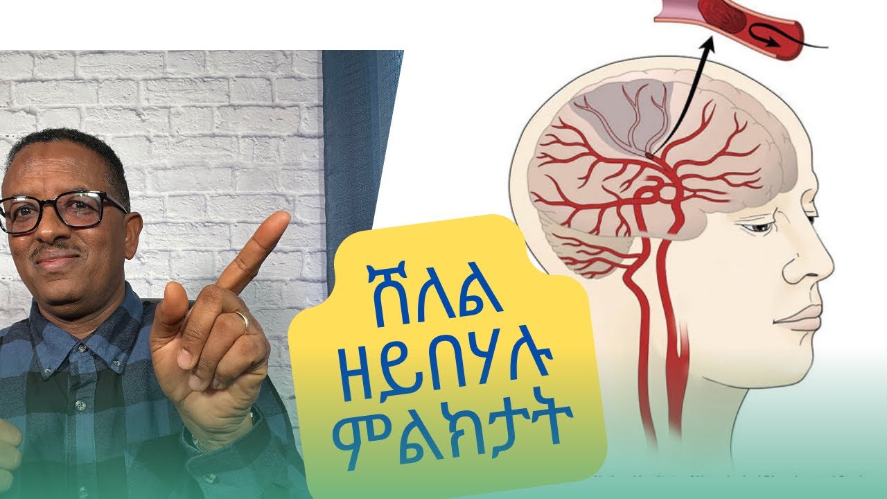 ወቕዒ ሓንጎል (Stroke) ከይኸውን!!!