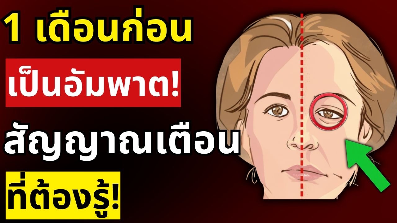 หมอเตือน! 7 สัญญาณเตือนอัมพาตล่วงหน้า 1 เดือน ที่คนส่วนใหญ่ไม่รู้ | สุขภาพผู้สูงอายุ