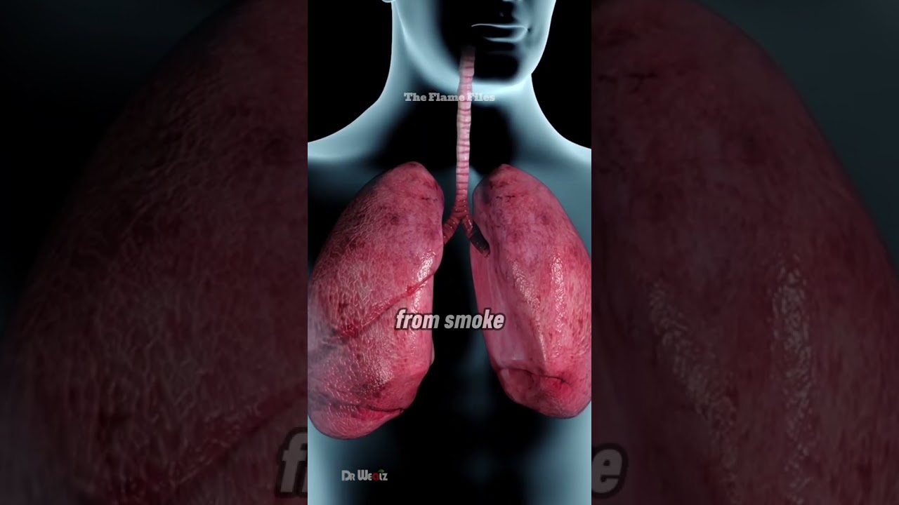 Why Smoke Is More Deadly Than Fire in a House Fire #firefighter #fire #wildfire