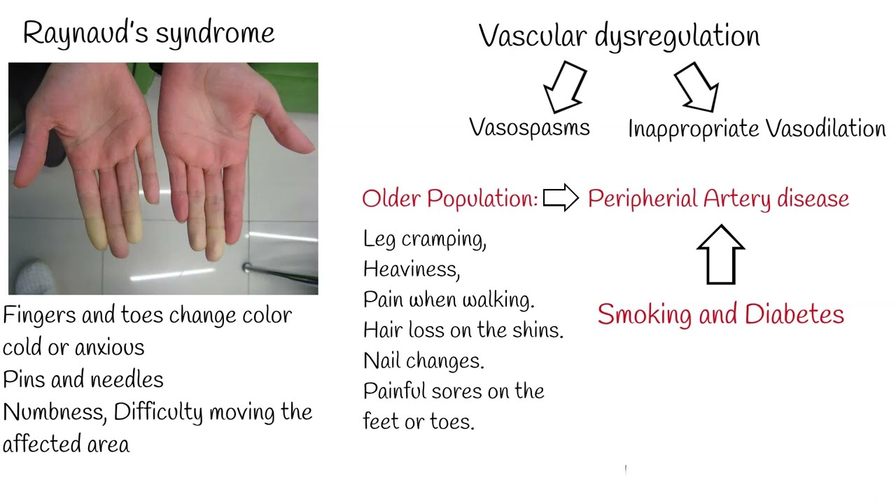 What causes cold hands and feet? always cold feet causes and treatment