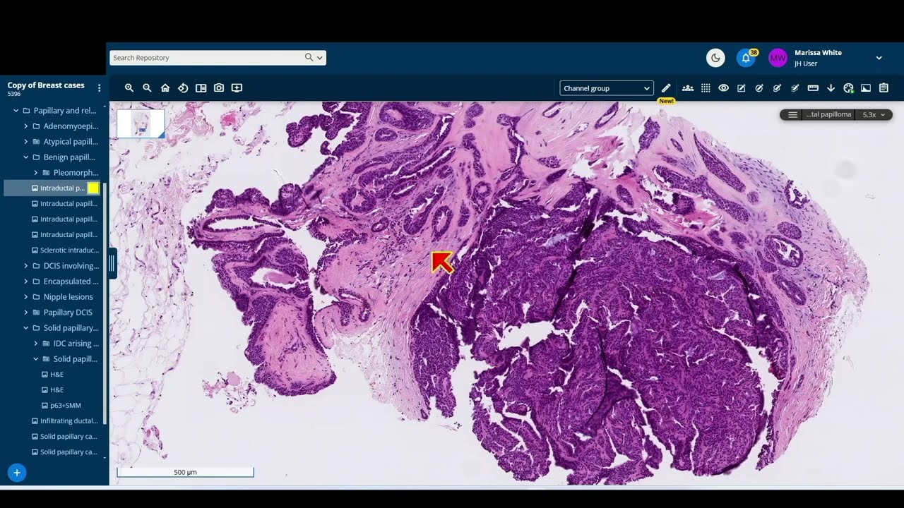 2025 Surgical Pathology Update: Diagnostic Pearls for the Practicing Pathologist: Vol. IX