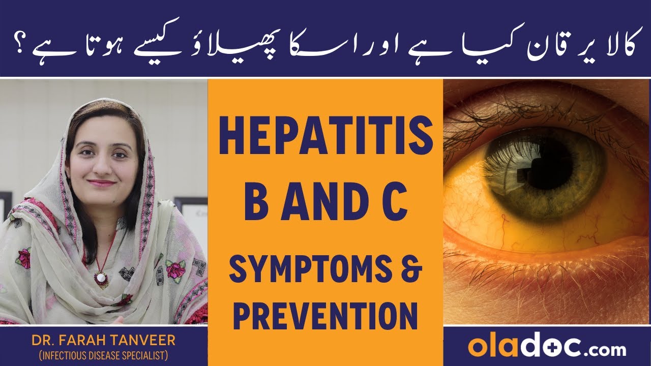 Hepatitis B And C Symptoms Prevention - Kala Yarkan Kaise Hota Hai- Hepatitis B/C Ki Alamat Aur Ilaj