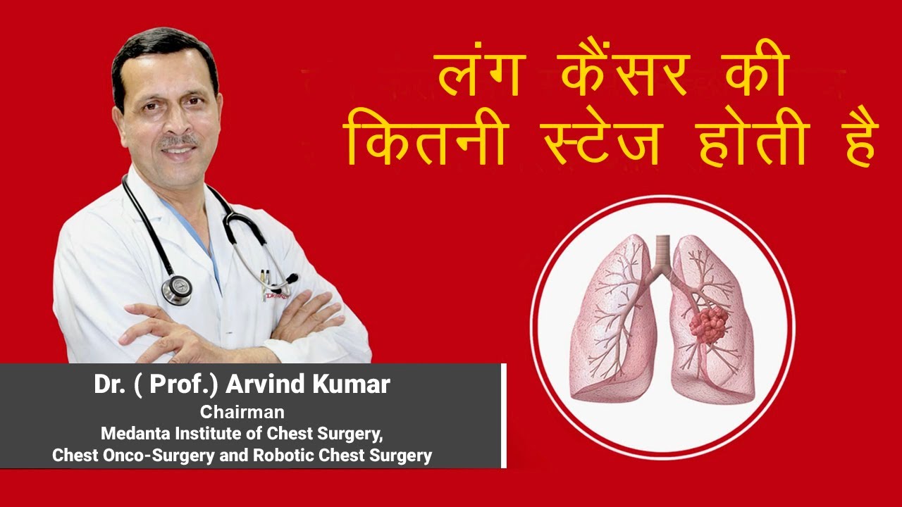 लंग कैंसर की कितनी स्टेज होती है (Stages of Lung Cancer in Hindi) - Dr. Arvind Kumar | +919773635888
