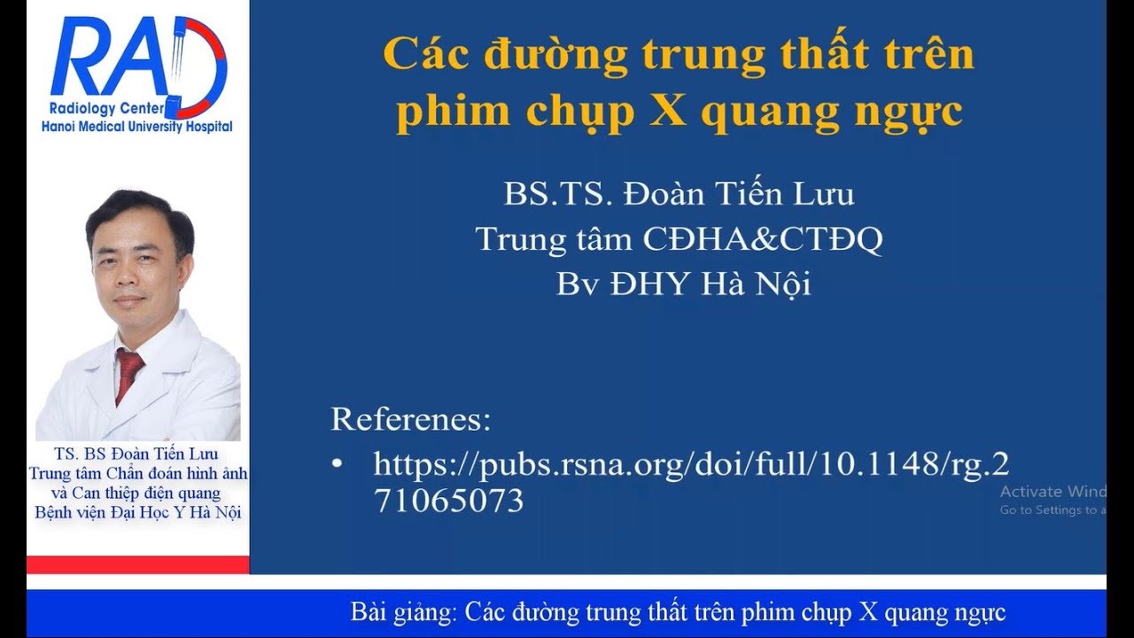 Hình ảnh các đường trung thất trên phim X quang ngực tiêu chuẩn