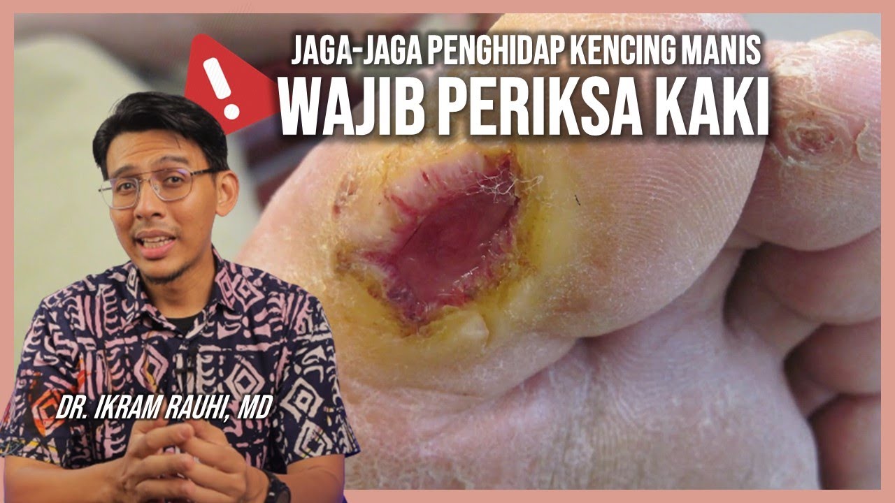Wajib Periksa Kaki - Bagi Penghidap Kencing Manis
