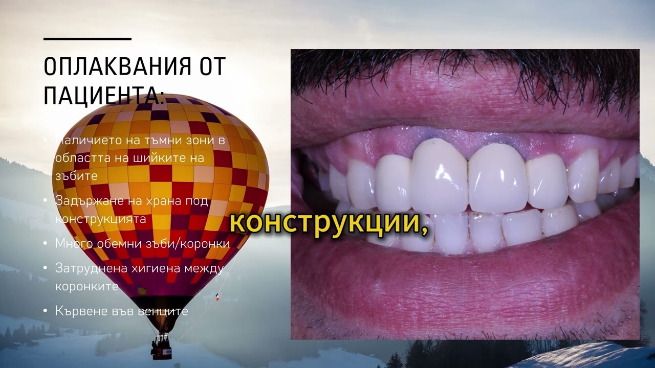 Преди и след:🦷 Нова усмивка с цирконий | Д-р Синей – СитиДент Пазарджик