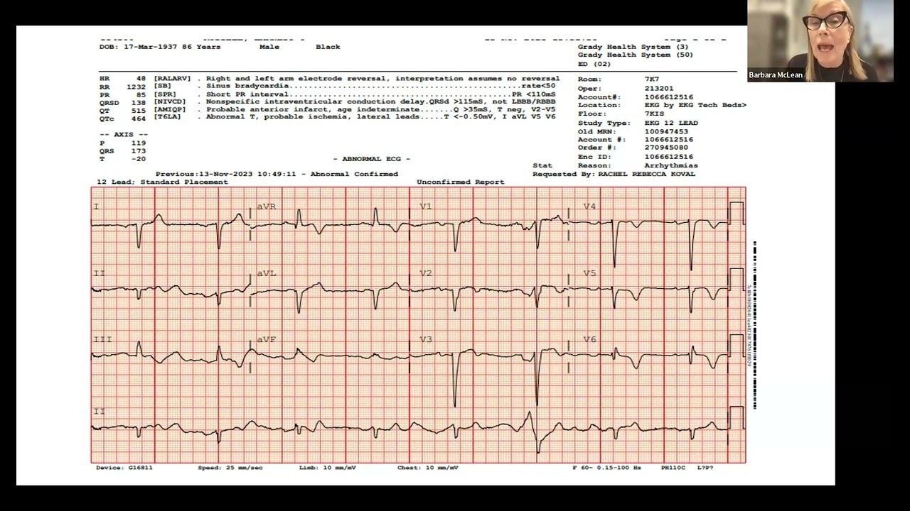 Critical Care in Covid