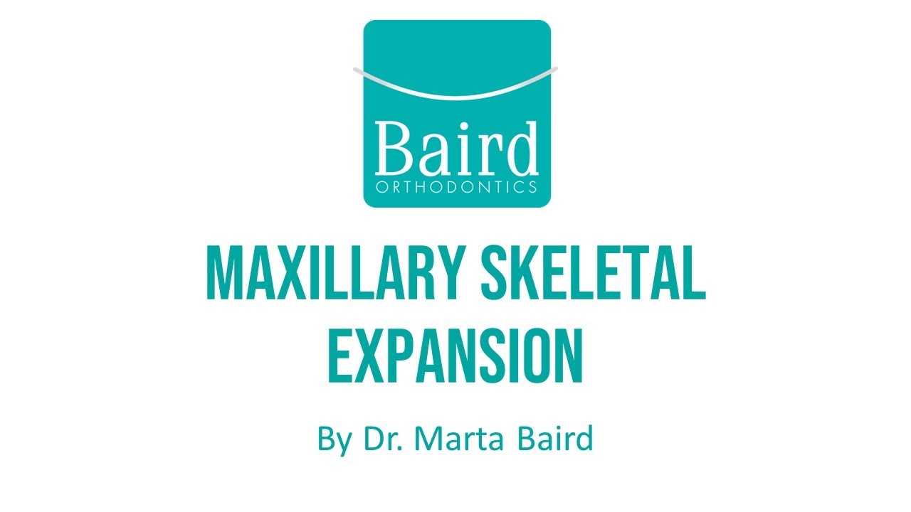 Orthodontic Maxillary Skeletal Expansion: Traditional & Invisalign(R) Palatal Expander