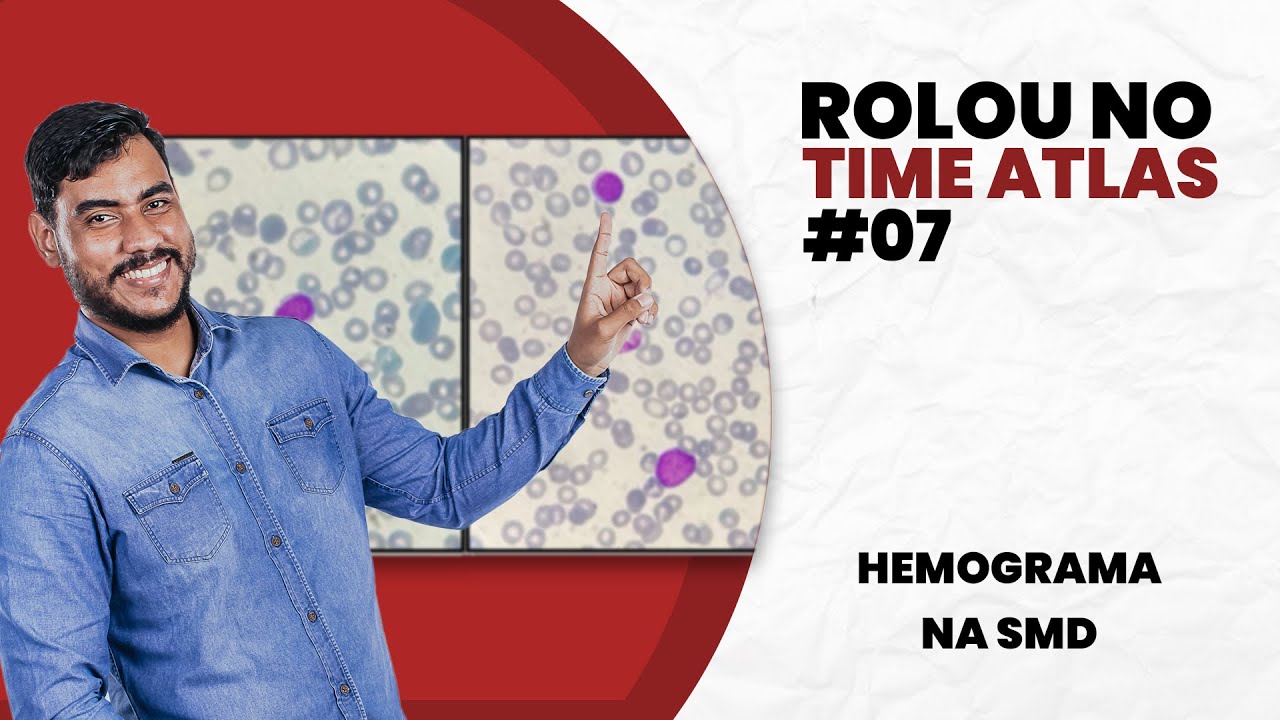 Síndrome Mielodisplásica-ROLOU NO TIME ATLAS #07