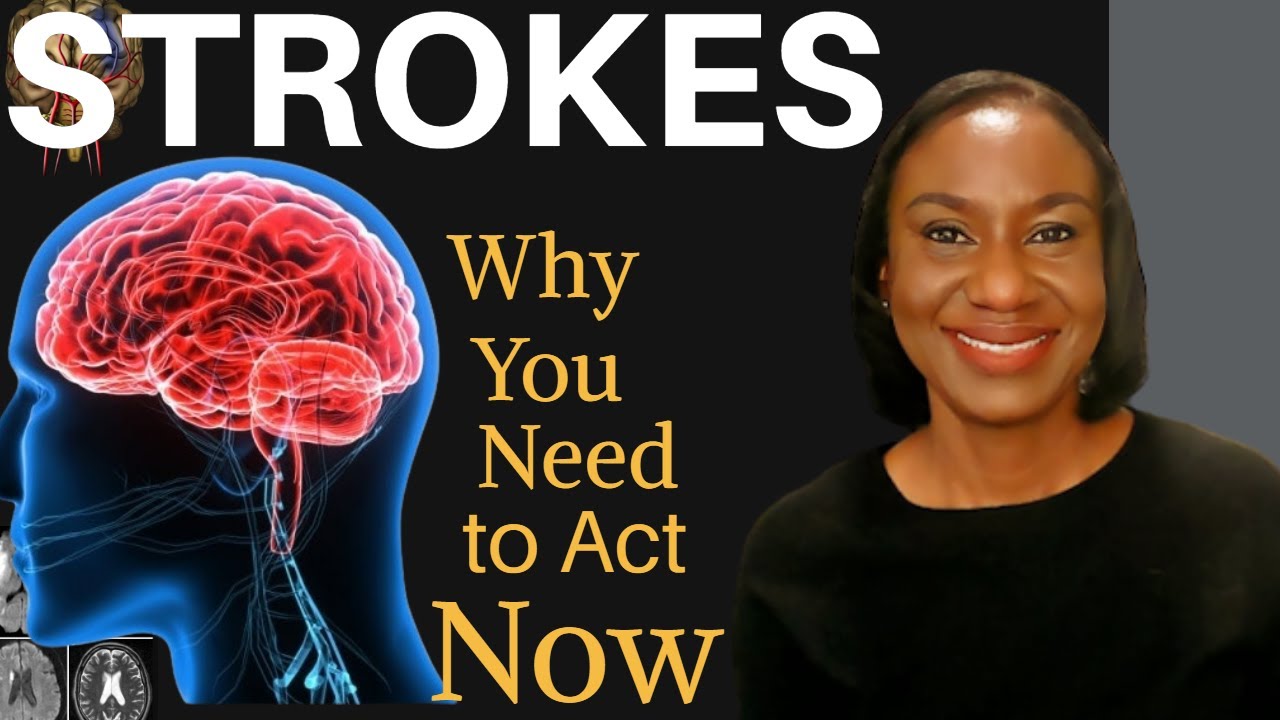 STROKES: What You Should Know, What You Should Do for Prevention.