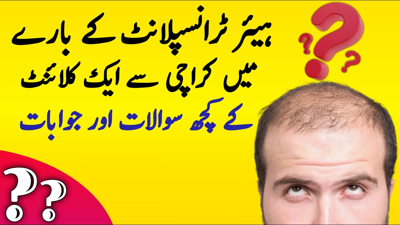 Hair Transplant Q&A: Client's Questions from Karachi | Expert Answers