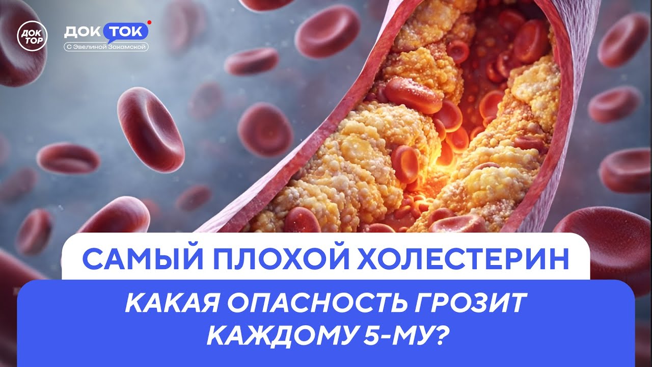 В чем частая причина инфарктов и инсультов / ДокТок с Эвелиной Закамской