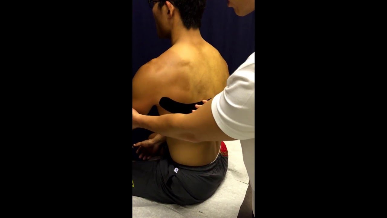 Latissimus Dorsi - Taping (KTape)