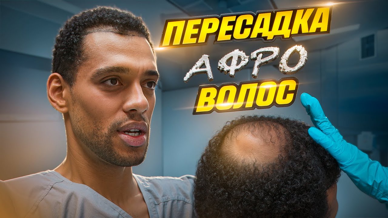 ПЕРЕСАДКА АФРО ВОЛОС АКТЕРУ ИЗ БЕЛАРУСИ