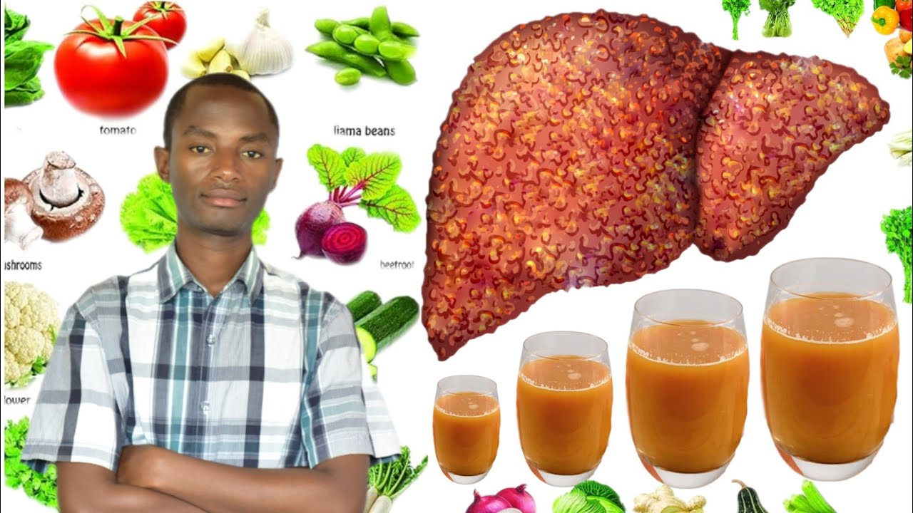 Ngibi ibiribwa abarwayi b'umwijima bose bakwiriye kurya.  Birinda uburwayi bw'umwijima.