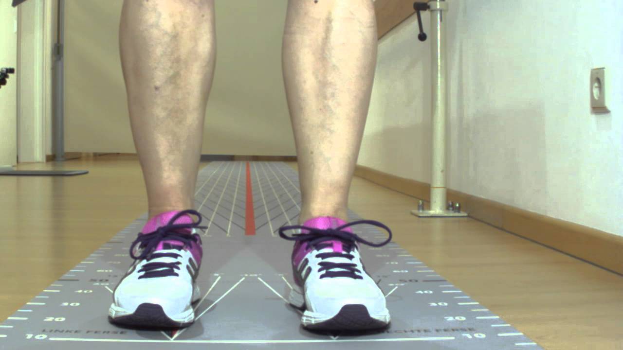 Funktionelle Elektrostimulation (FES) mit Bioness L300 nach Apoplex
