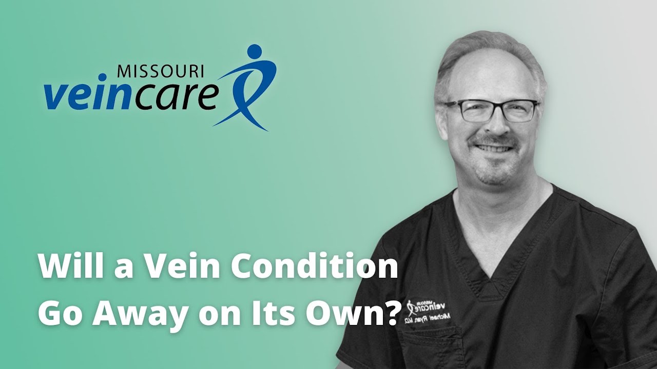 Will a Vein Condition Go Away on It's Own?