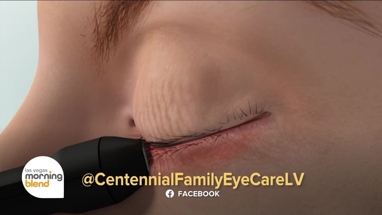 A High-Tech Fix for Dry Eyes?