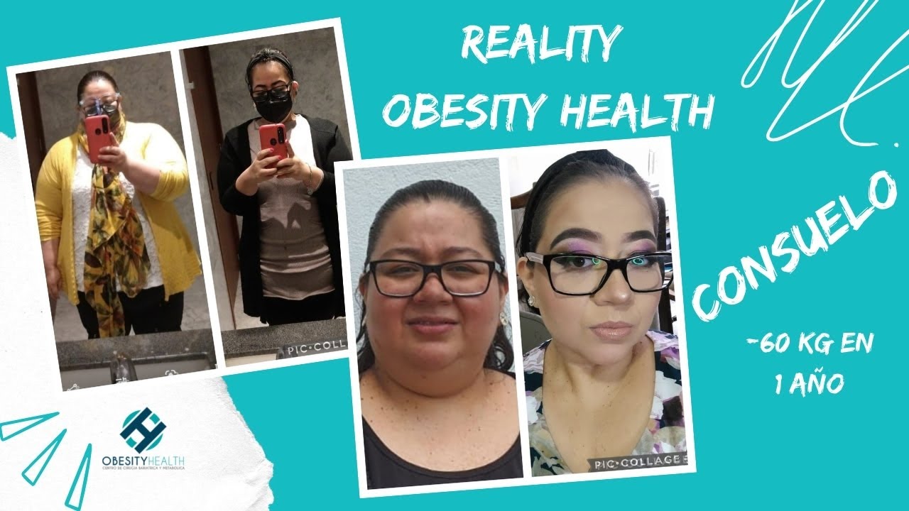 Reality Obesity Health: Consuelo ha perdido -60 Kg en 1 Año