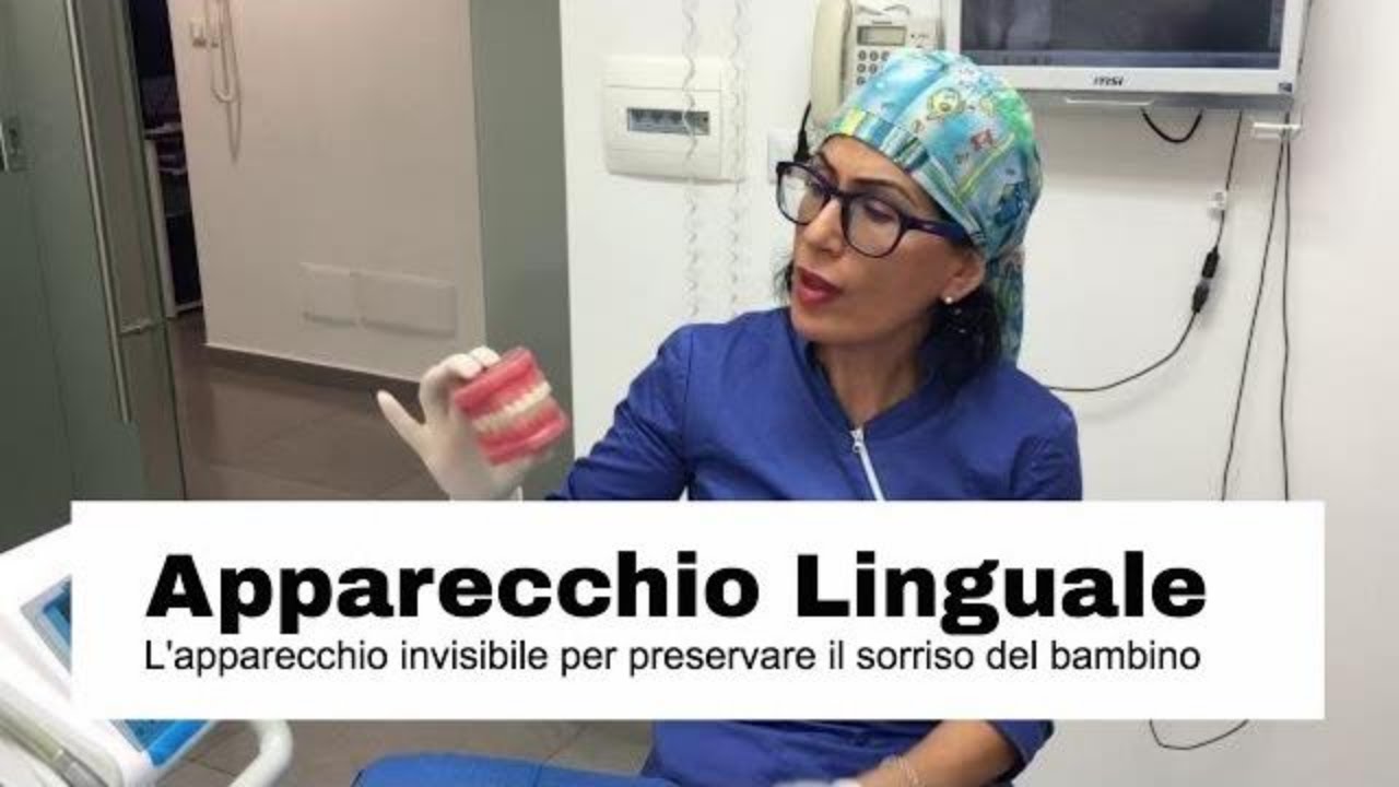 Apparecchio linguale, l'apparecchio invisibile per preservare il sorriso del bambino