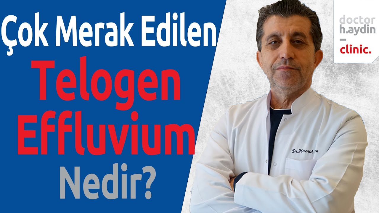 Çok Merak Edilen Telogen Effluvium Nedir?
