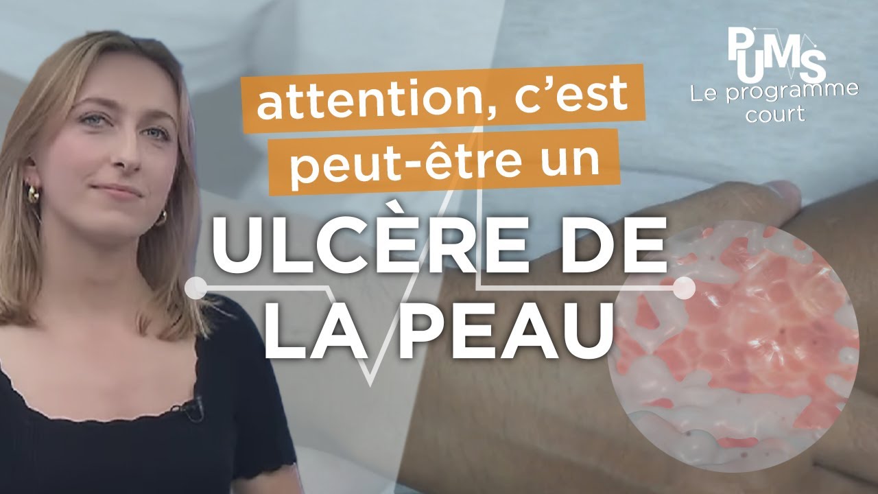 Reconnaître un ulcère de la peau / Ulcère cutané. Attention aux lésions suspectes.
