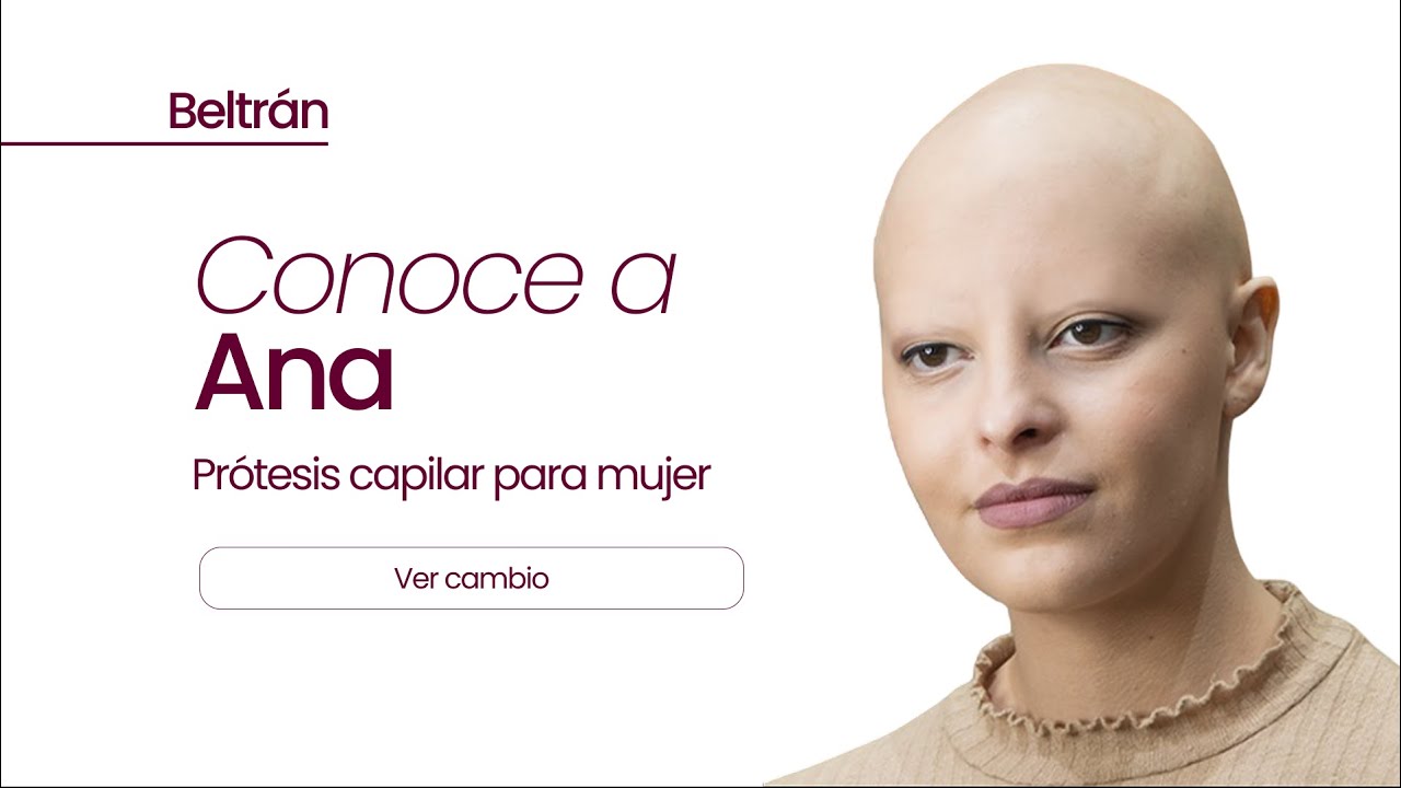 Prótesis capilar a medida indetectable de cabeza completa