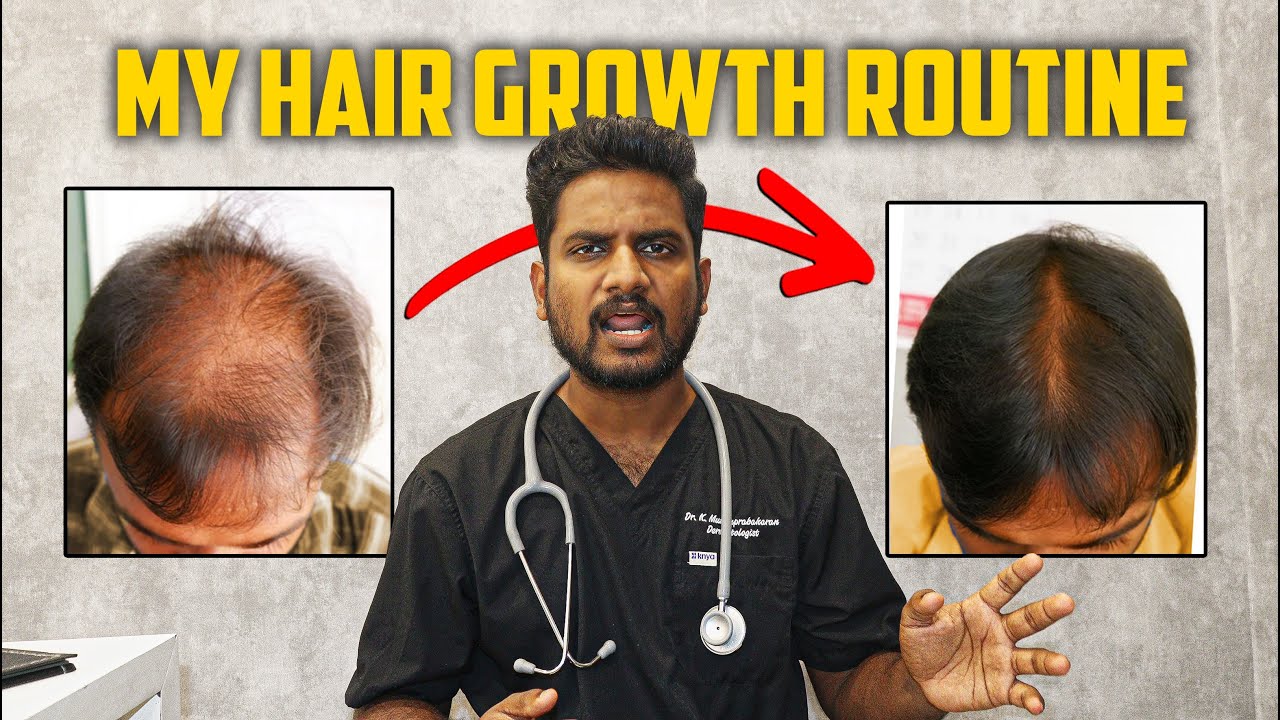 How to stop hair fall forever - My easy 5 Step Guide !