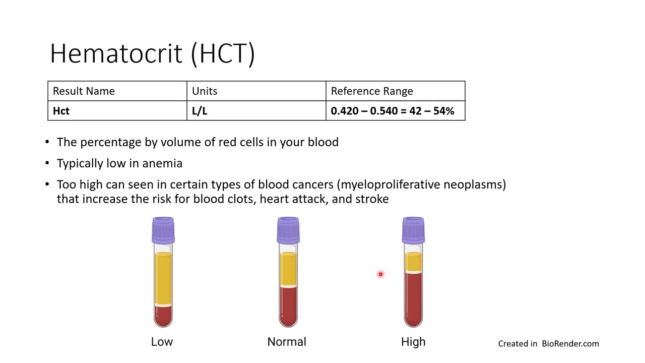 Understanding Your Lab Results