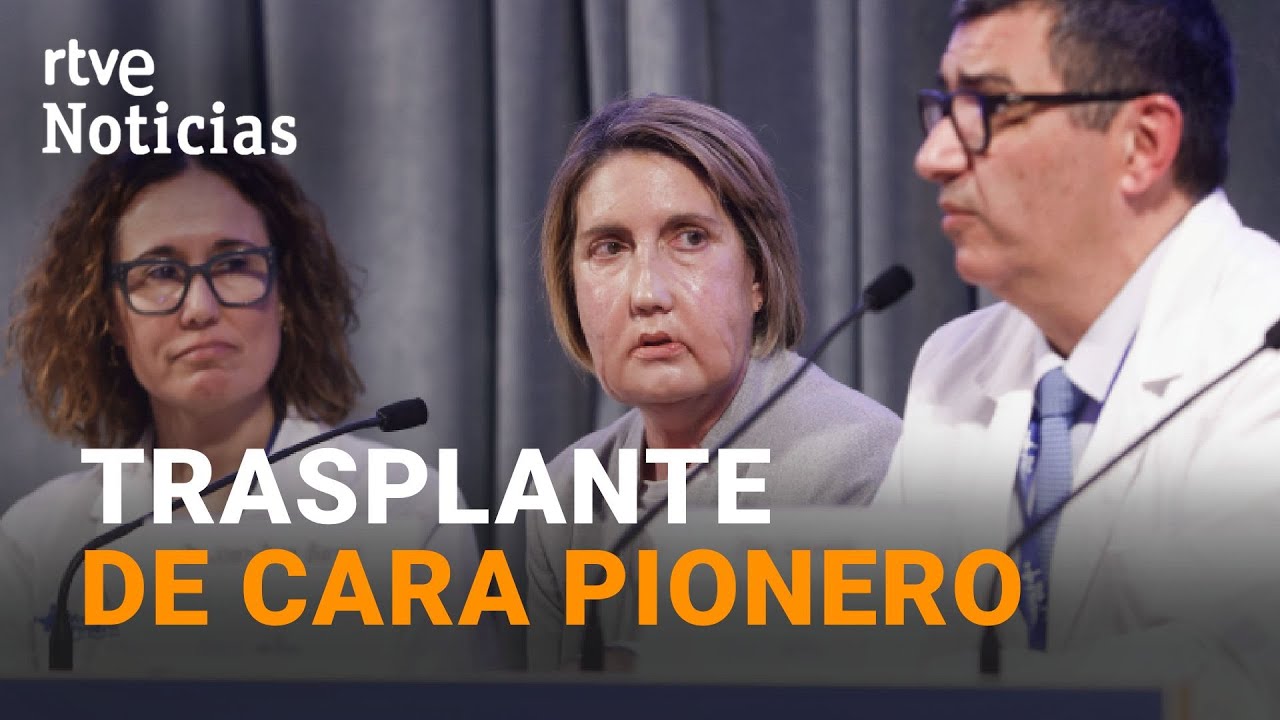 HITO MÉDICO | Primer TRASPLANTE de CARA del MUNDO a partir de una DONANTE que pidió la EUTANASIA
