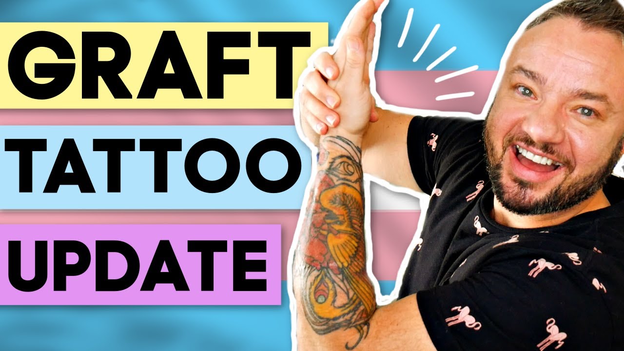 Arm and Skin Graft Recovery at 5 Years Post-Phalloplasty And Tattoo Update