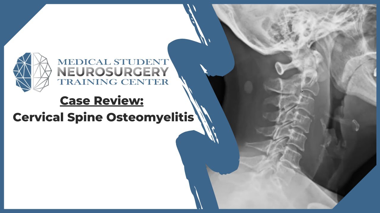 Case Review: Cervical Spine Osteomyelitis