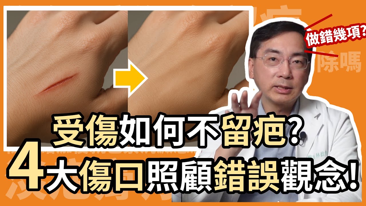 受傷如何不留疤？4大傷口照顧錯誤觀念！尤其是最後一點！