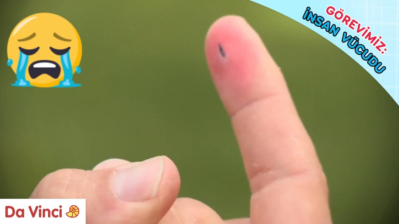 Kıymık Batması 😭 - Görevimiz: İnsan Vücudu | Da Vinci TV Türkiye