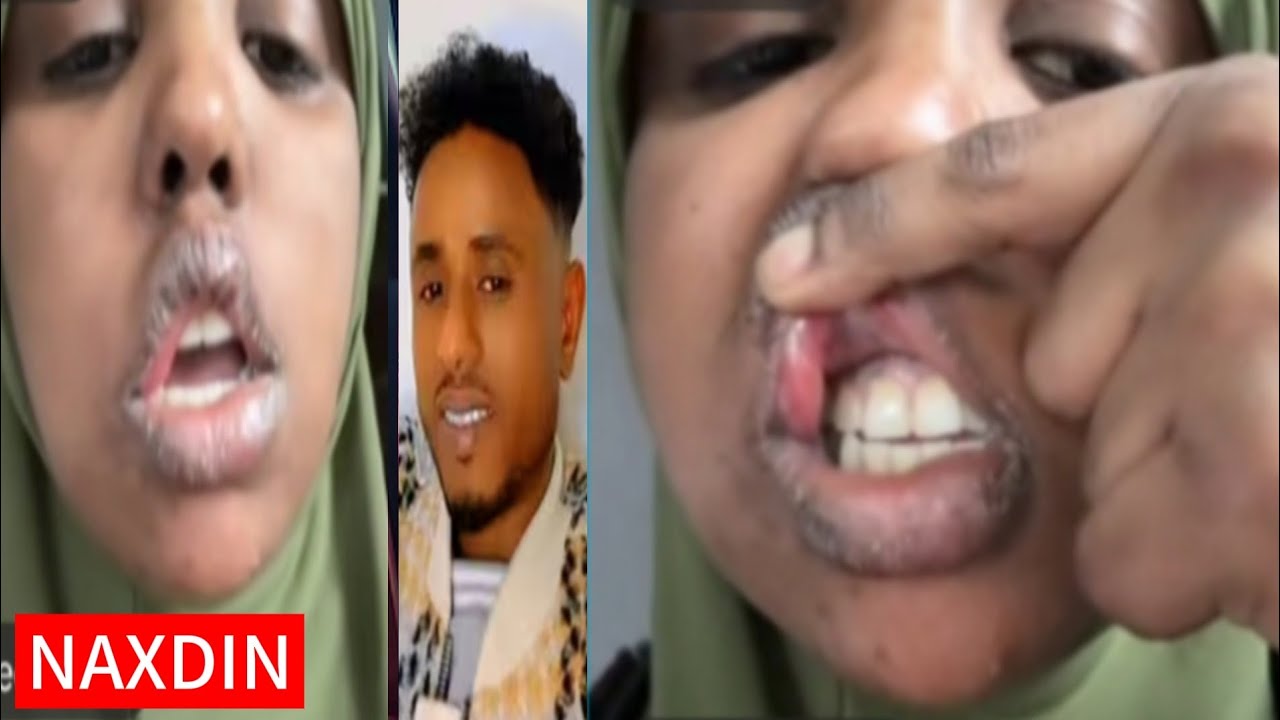ISTAAHIL DILKA U RASHKA U  GEYSTAY DARTII JAHADA DHAN KA LUNTAY 