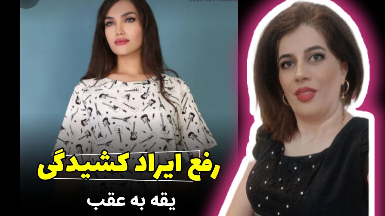 رفع کشیدگی یقه لباس به سمت پشت