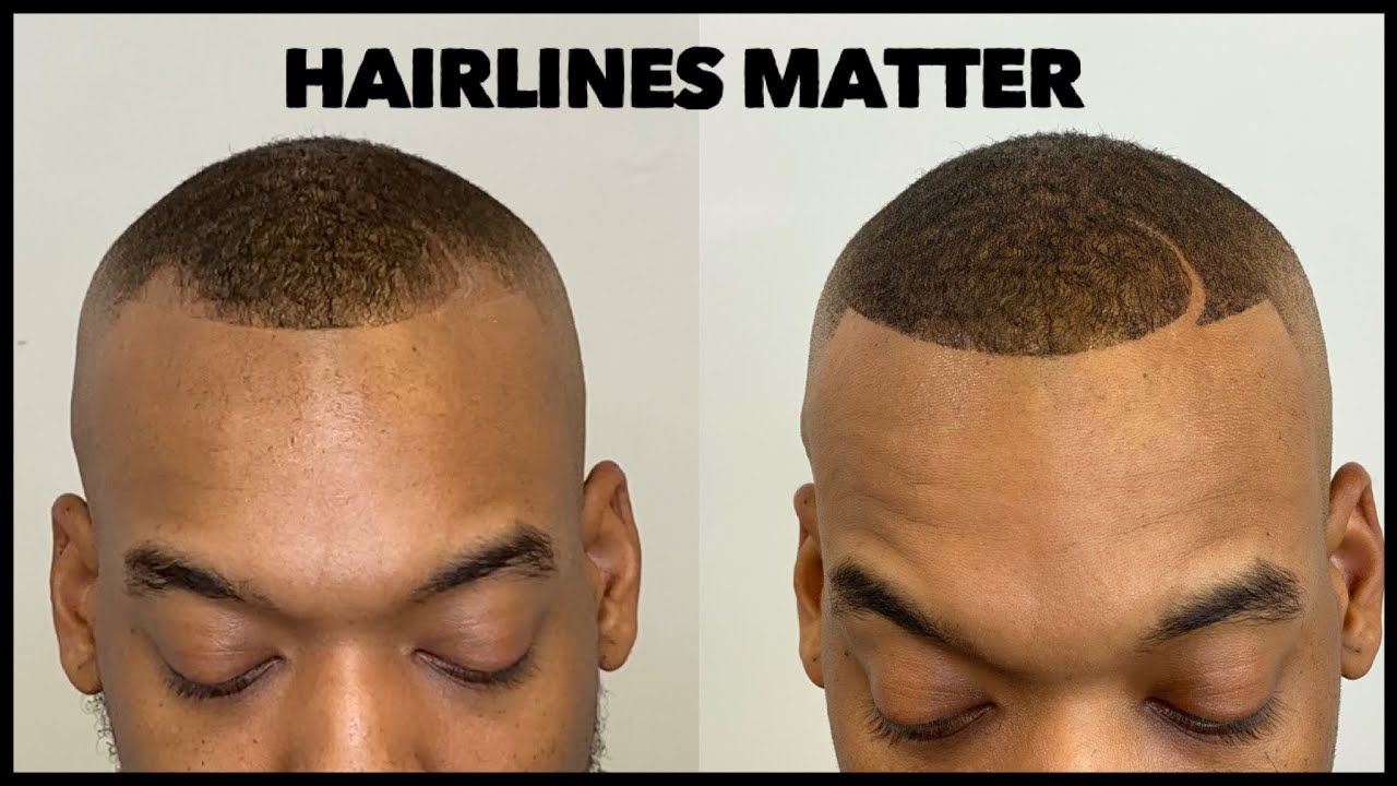 Hairlines Matter