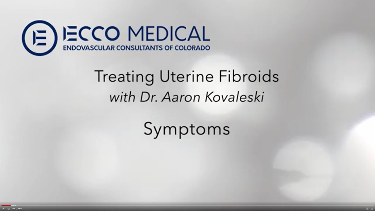 UFE -Uterine Fibroid Embolization Patient Education
